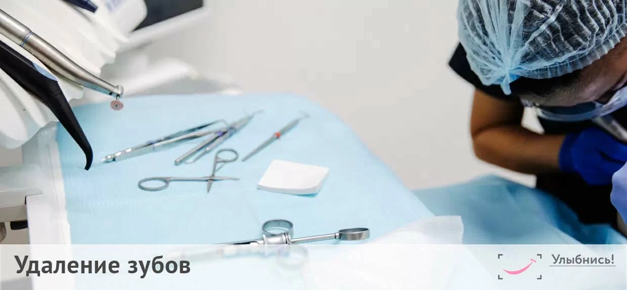 Удаление зубов Удаление зубов