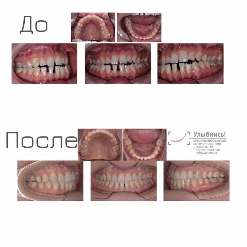 Ортогнатическая хирургия