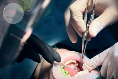 Что такое цистэктомия? Что такое цистэктомия?