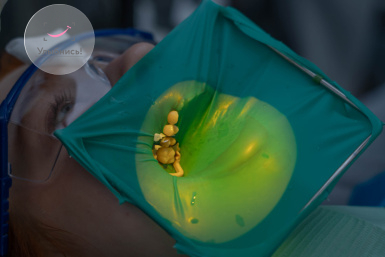 Пломбирование каналов зубов штифтом Пломбирование каналов зубов штифтом