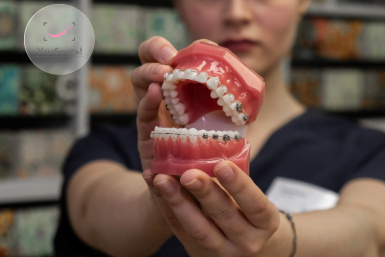 Особенности открытого прикуса Особенности открытого прикуса